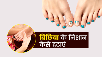 बिछिया पहनने से पैर की उंगलियों में पड़ गए निशान? इन घरेलू उपायों से करें ठीक